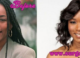 Angela Bassett Plastic Surgery