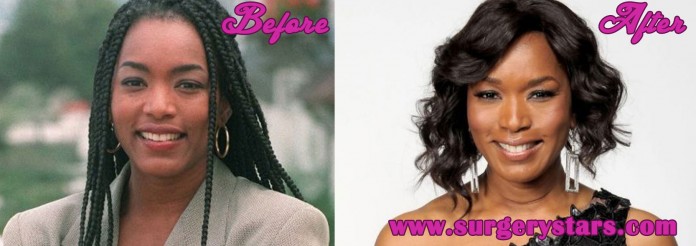 Angela Bassett Plastic Surgery