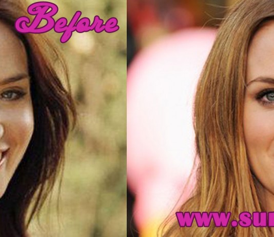 Emily Blunt Plastic Surgery
