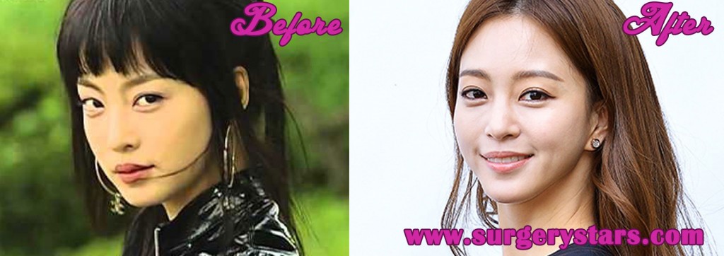 Han Ye Seul Before And After Pictures
