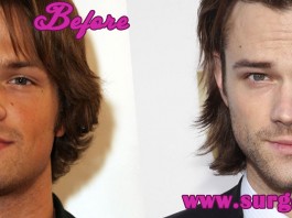Jared Padalecki Nose Job