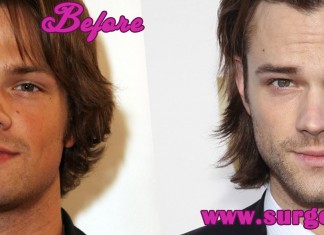 Jared Padalecki Nose Job