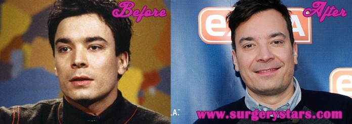 Jimmy Fallon Plastic Surgery