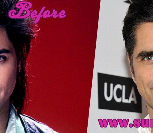 John Stamos Plastic Surgery