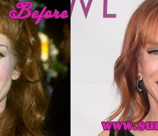 Kathy Griffin Plastic Surgery