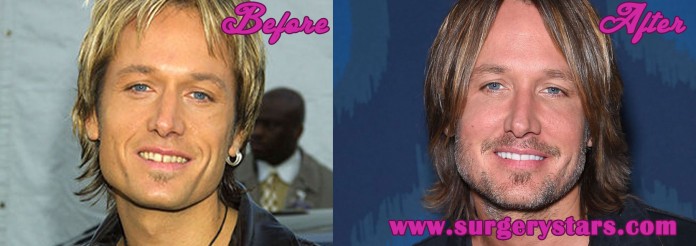 Keith Urban Plastic Surgery