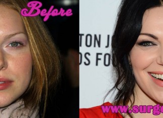 Laura Prepon Plastic Surgery