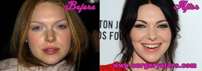 Laura Prepon Plastic Surgery