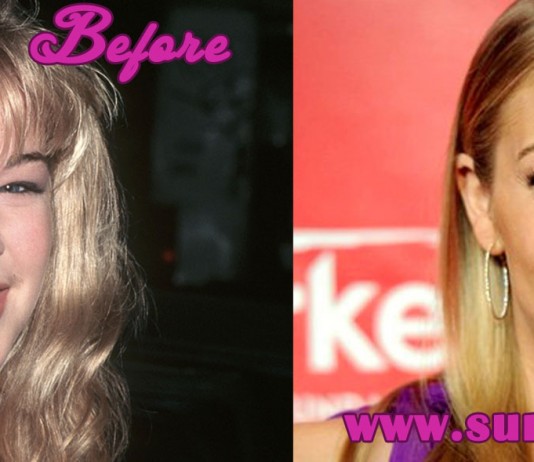 Leann Rimes Plastic Surgery