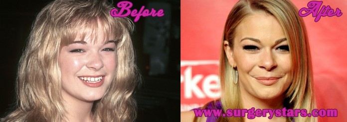 Leann Rimes Plastic Surgery