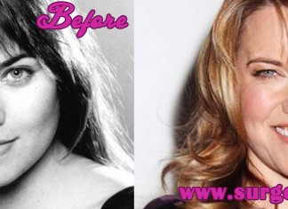 Lucy Lawless Plastic Surgery