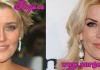 Mckenzie Westmore Plastic Surgery Before and After