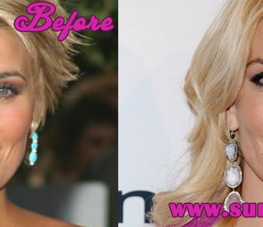 Mckenzie Westmore Plastic Surgery Before and After