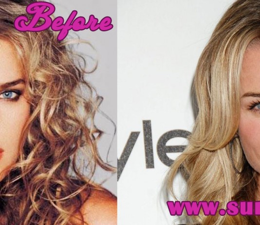 Rebecca Romijn Plastic Surgery