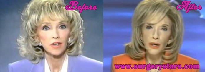 Rexella Van Impe Plastic Surgery