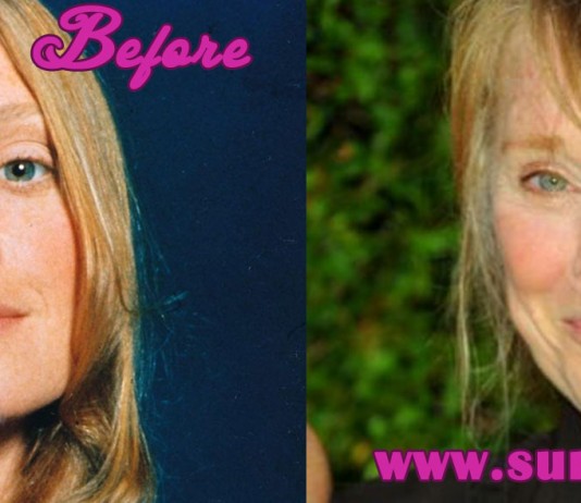 Sissy Spacek Nose Job