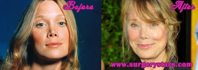 Sissy Spacek Nose Job