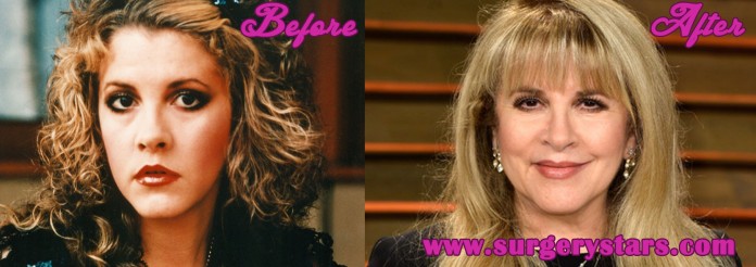 Stevie Nicks Plastic Surgery