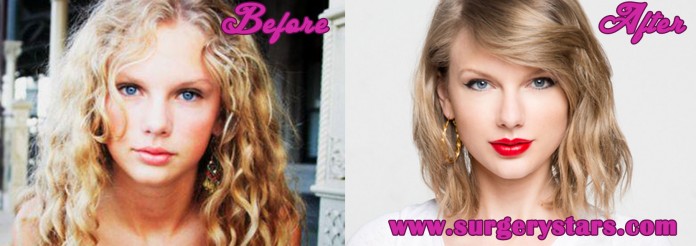 Taylor Swift Plastic Surgery