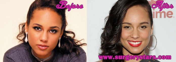 Alicia Keys Plastic Surgery