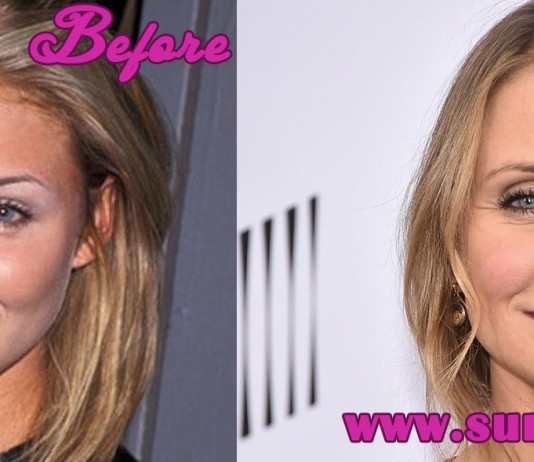 Cameron Diaz Plastic Surgery