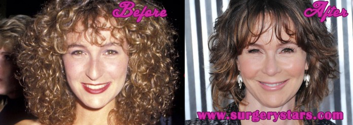 jennifer gray plastic surgery