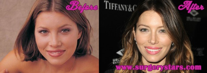 jessica biel plastic surgery