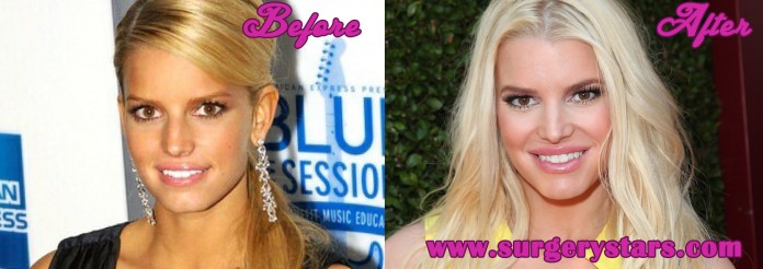 jessica simpson plastic surgery