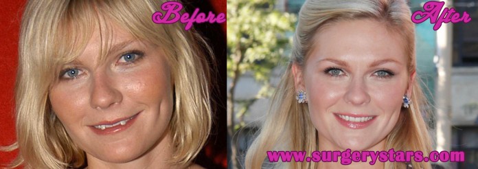 kirsten dunst teeth