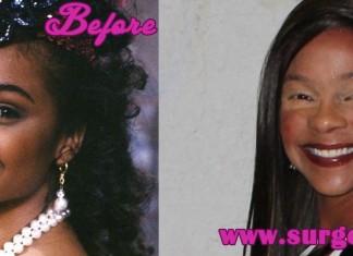 lisa turtle plastic surgery