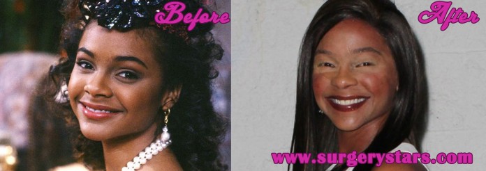 lisa turtle plastic surgery