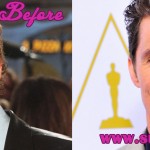 Matthew McConaughey Plastic Surgery