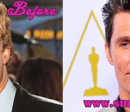 Matthew McConaughey Plastic Surgery